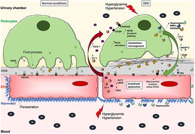 Glomerular Endothelial Cell Crosstalk With Podocytes in Diabetic Kidney Disease